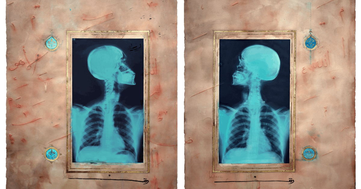 Illuminations: A series that merges medical X-rays with Islamic calligraphy, symbolizing the intersection of faith and science.